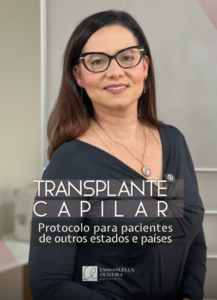 transplante capilar em maceió, como funciona