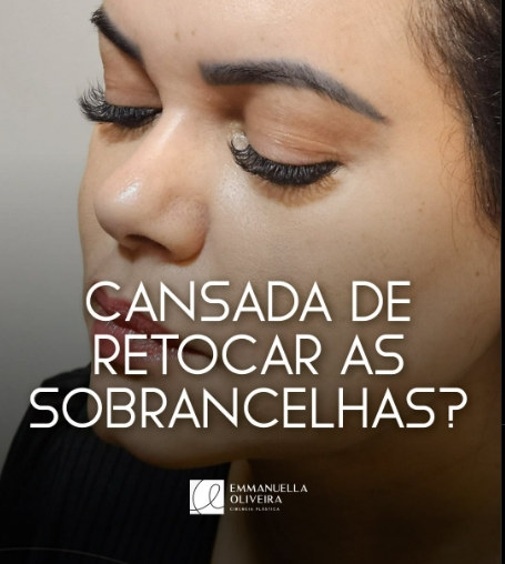 transplante de sobrancelhas - técnica fue