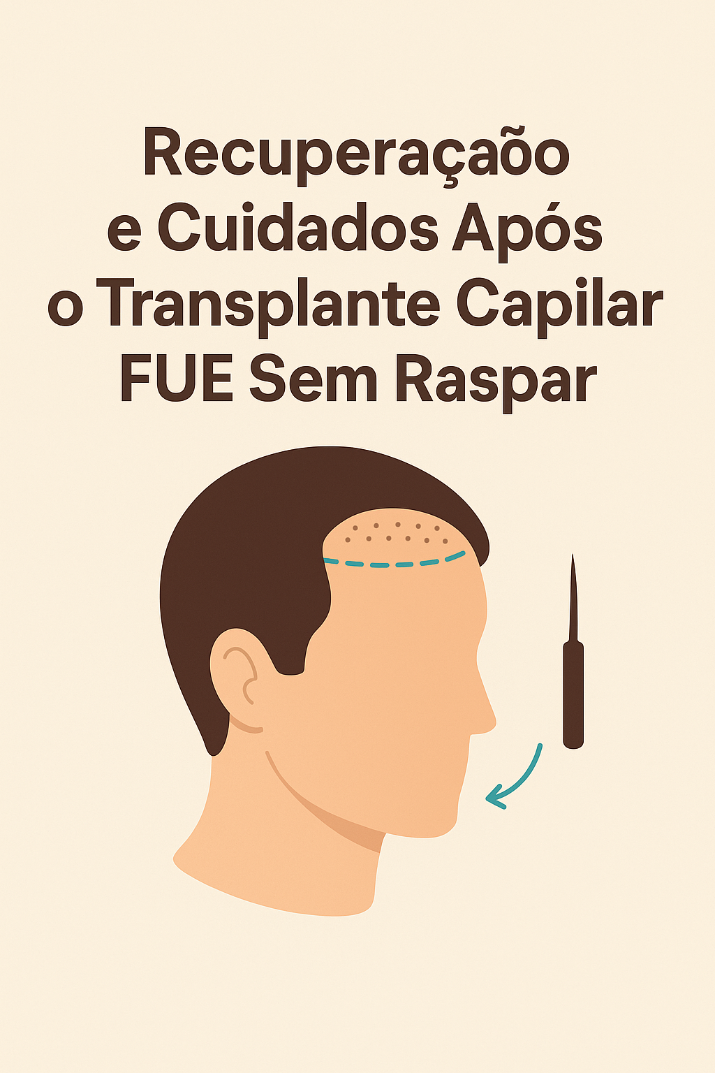 Recuperação e Cuidados Após o Transplante Capilar Sem Raspar