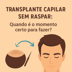 Transplante Capilar Sem Raspar Quando é o Momento Certo para Fazer