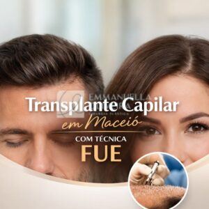 Transplante capilar em Maceió: referência, técnica FUE e resultados naturais